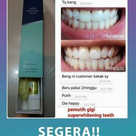 JUAL PASTA GIGI TIENS HERBAL PERONTOK KARANG GIGI TERBAIK DI JAKARTA BARAT